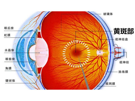 不同类型的视网膜色素变性